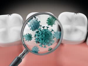 Karies als Ursache von Zahnschmerz