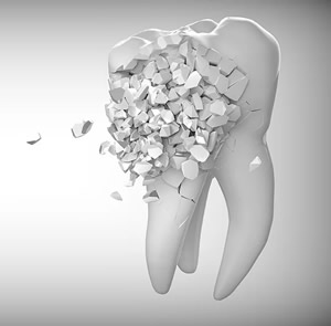 Wie die Zahnzusatzversicherung funktioniert